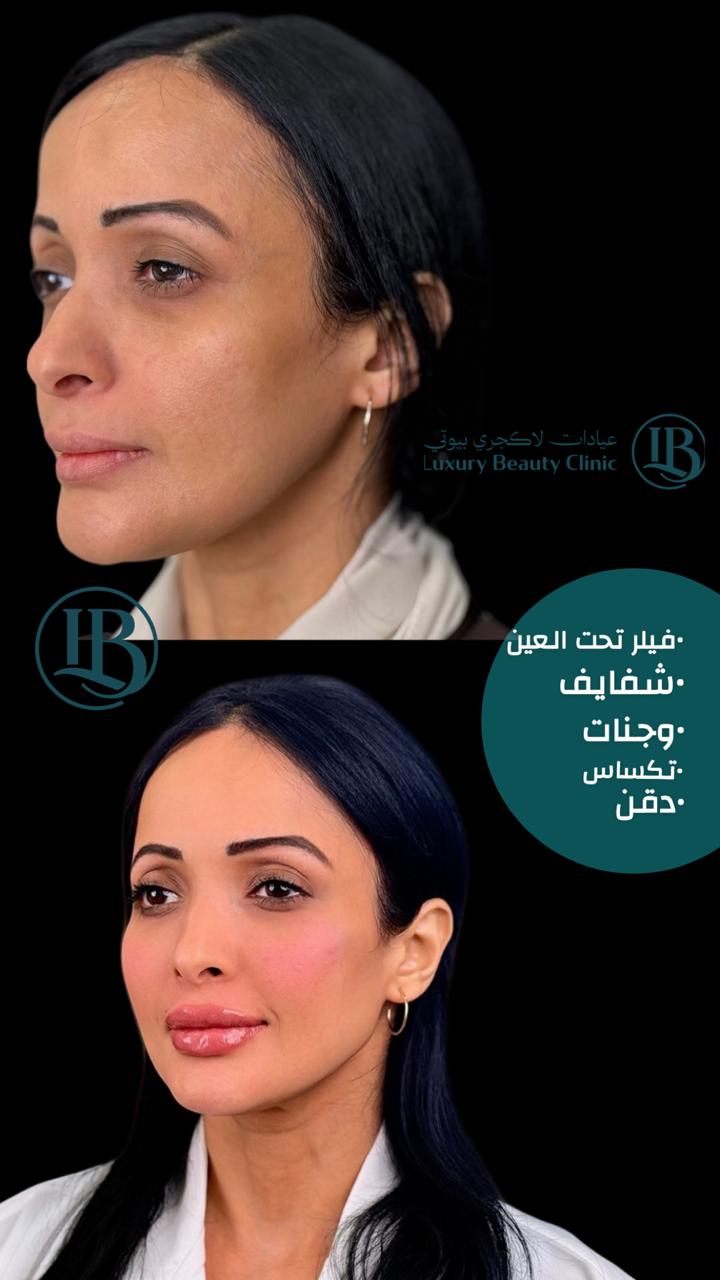 before-after-1