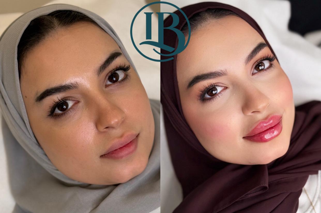 before-after-2