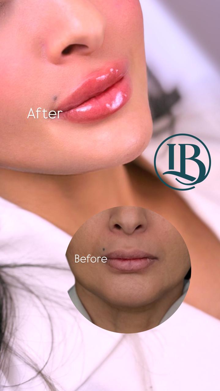 before-after-3