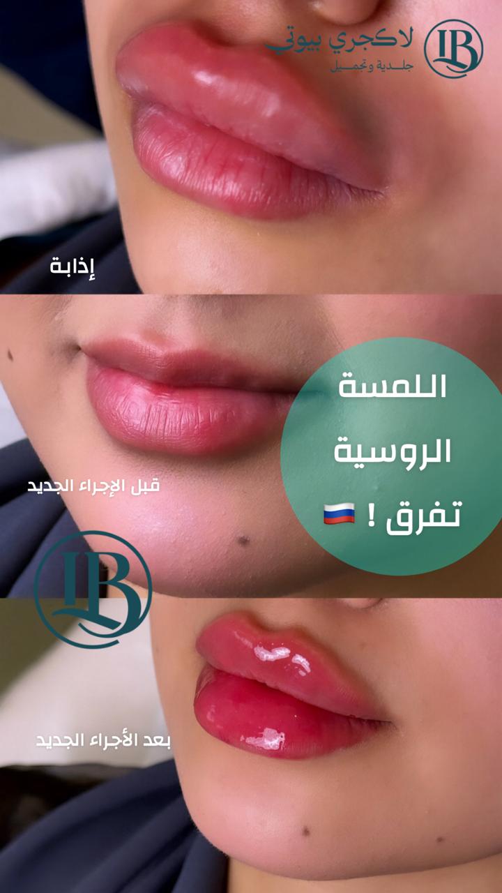 before-after-4