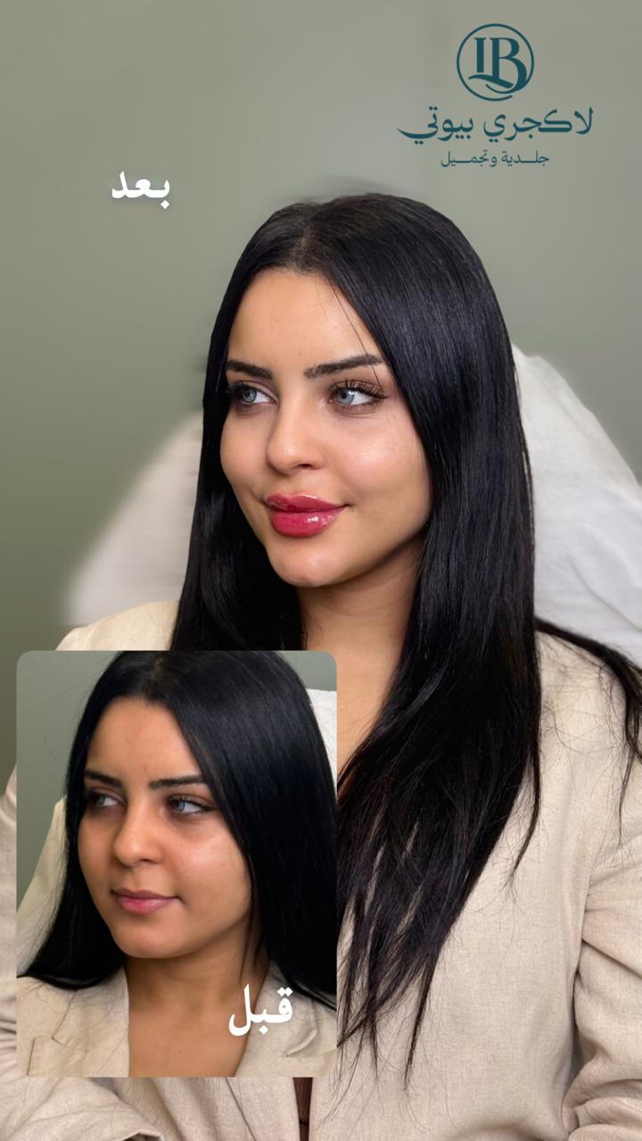 before-after-5