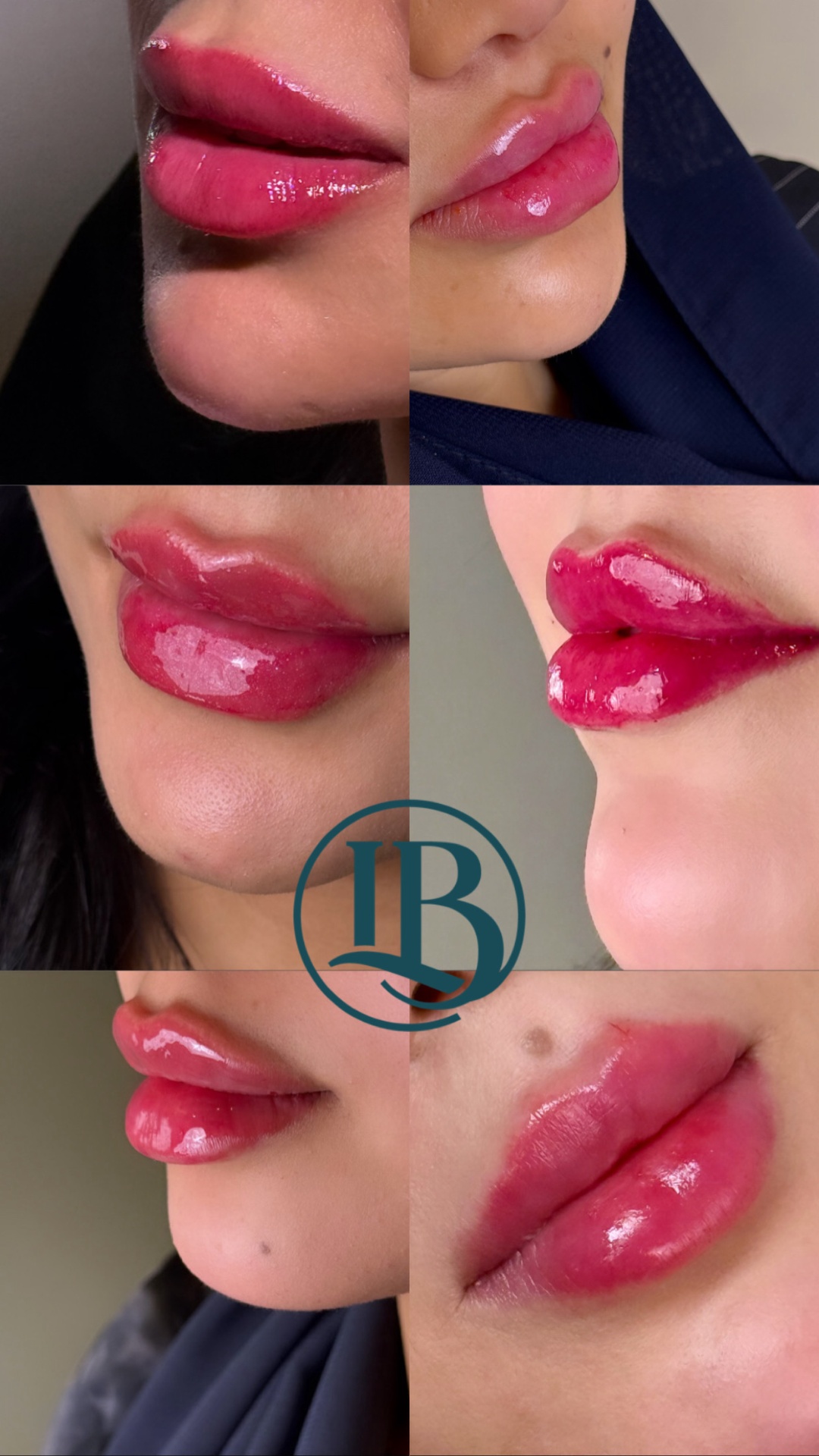 before-after-6