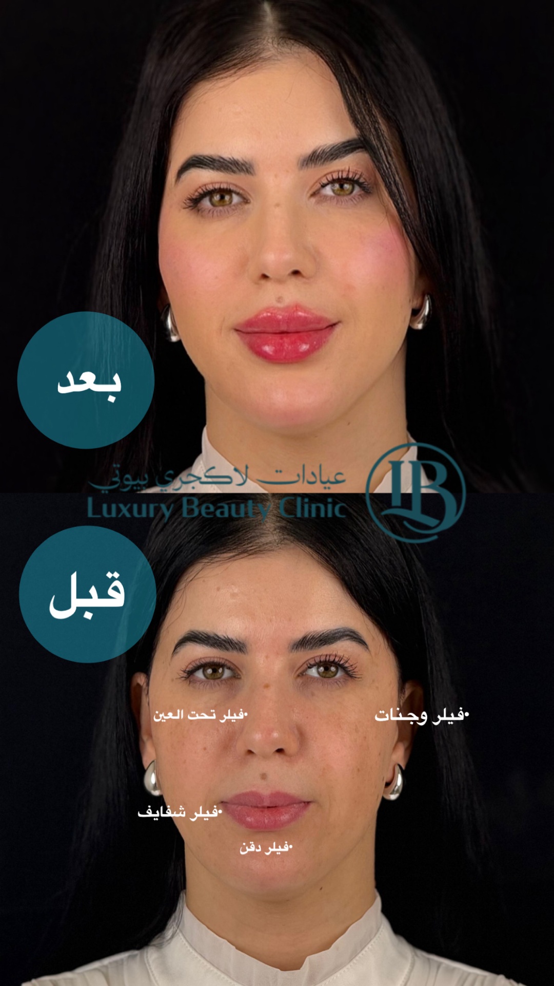 before-after-7