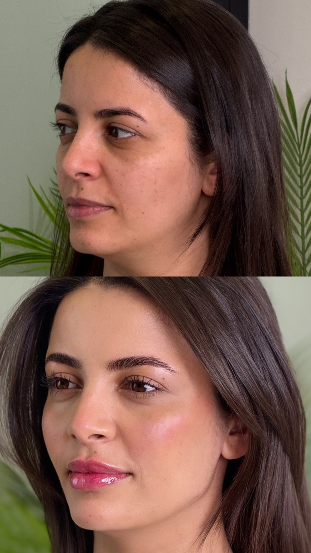 before-after-8